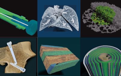 Microtomografía de Rayos X (MICRO-CT)